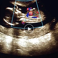 感恩！终于盼到了你的到来