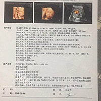 大家帮我看一下男宝还是女宝谢谢