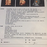男孩还是女孩