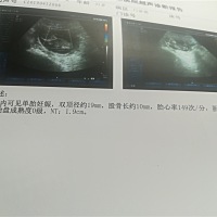 宝妈们有没有能看出来男孩女孩，今天体检一切正常