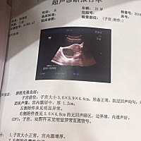 月经推迟快两个月了！今天去看也没怀孕！怎么会这样