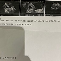 正在准备东西，好奇而已，男宝还是女宝，我好买东西起名字😄😄