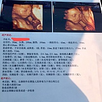 今天刚做的四维宝宝很配合十几分钟就搞定了，大家帮忙看一下男宝还是女宝