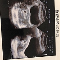 这样是男孩女孩