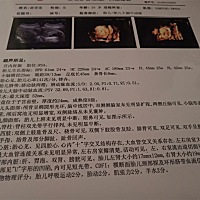 28周了。四维彩超做了。医生说宝宝头.手脚，还有双肾都偏小了。大帮我给我点意见，看看有没有什么问题？