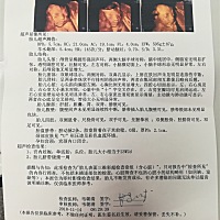 来讲讲男女，三维如图，孩子已经满月，性别男，欢迎参考