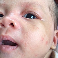 各位宝妈，看看眼角那是胎记吗？刚出世的时候没有。大概半个月左右就明显看出来了