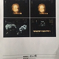 四维一次顺利通过！医生说宝宝合作😌