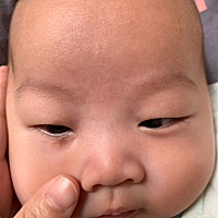 既然不是胎记，那这是什么，两个月了还不消失，懂的人告知下，谢谢了🙏