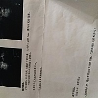 都说是男宝，你们觉得呢