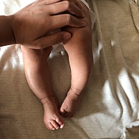 孩子现在三个月了，左脚受力的时候就会向内翻，图一是内翻的，图二是自然放松的。不知道这是不是足部畸...