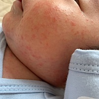 有人知道这是什么原因吗？应该怎么办？