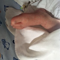 宝宝今天22天，脚丫发现许多小红点，各位大神帮忙看一下是怎么回事