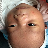 这到底是湿疹还是痤疮？医生说是疮，让擦百多邦，擦了几天没效果，其它地方又长了，又有人说是湿疹，还...