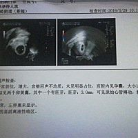 有没有六周去检查是两个卵黄囊，八周去检查就只看到一个胎心的。这个是怎么回事，落差好大呀！