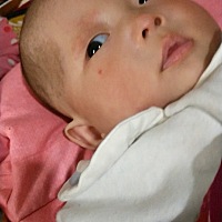 我女儿脸一粒红红的是什么呀