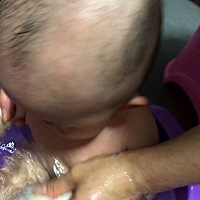 大家帮帮忙 请问 宝宝生出来 头2边的头发很少 是 绒绒毛 一点点 我把她头发剃了后 这2边还是绒绒毛 一点...