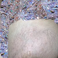 宝妈们，你们胸哪里会长妊唇纹吗？我这种是不是长了妊唇纹？