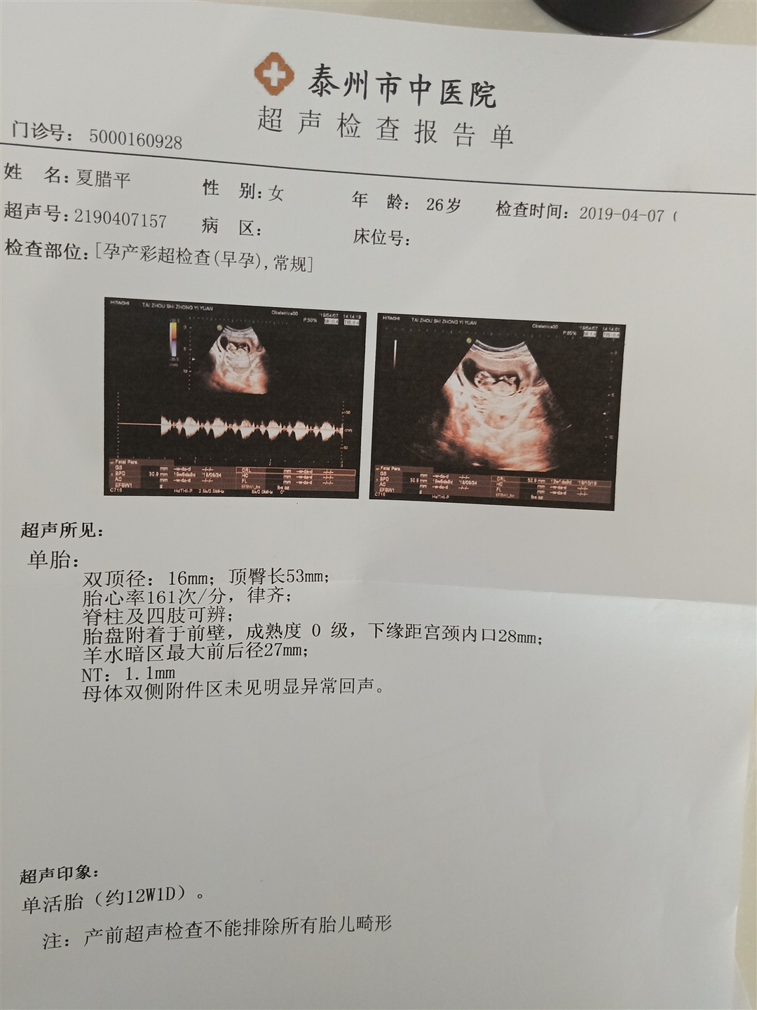 是乔治还是佩琪啊