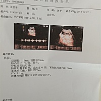 现在能看得出来男女吗，好想生个佩琪啊，家里已经有个乔治了，求了解的人指导一下 是乔治还是佩琪啊