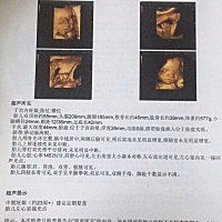 四维不通过，好担心啊，有没有同款宝妈？头胎是男宝，这胎希望是女宝，我和我老公都特别想要个女儿！