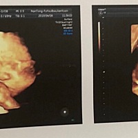 做的四维 有没有同款在肚子里吃手的宝宝😄