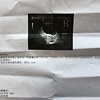 各位帮我看看。正常吗。有积液。3月5日末次