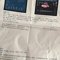 有会看男女的宝妈吗 帮忙看看呀