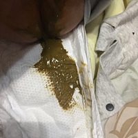 三个月宝宝拉的这种颜色便便，到底怎么回事，最近一直便秘