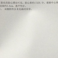 第一次检查，请大家帮我看看有没有问题，胎心率是不是太高了，另外孕酮是90.67