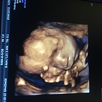 好神奇 都说是男孩子结果最后翻盘生了个小公举  第一次当妈妈对一切都是紧张又期待 生产过程很痛苦看着...