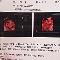 今天拍的四维彩超，现在才22周＋几。希望不是个小短腿