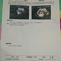 怀孕50天做的彩超