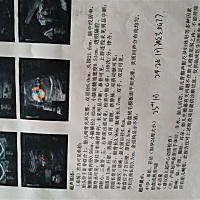 谁不想儿女双全呀，我想请问你们那些很闲的人，明知道我家老大已经上一年级了，是儿子，现在怀了老二，...