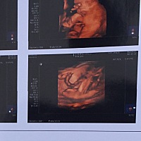 来几个懂点的朋友帮我看看是男宝还是女宝啊。🙏