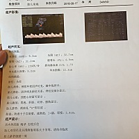 34周+3，这偏大两周多，好担心不能顺产啊，有没有类似的妈妈顺利生产的？