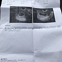 按上次月经末算应该是怀孕9周了，可是今天去检查有胎芽4mm但是没有胎心，医生建议流掉，可是我不想就这...