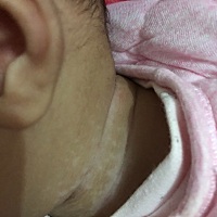 请问宝宝的脖子这样是什么原因呢？