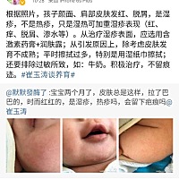 每张价值50元的图片🎉🎉 ❤️宝宝有以下皮肤问题的可以参考一下。都是其他宝宝一个问题咨询费50元付...