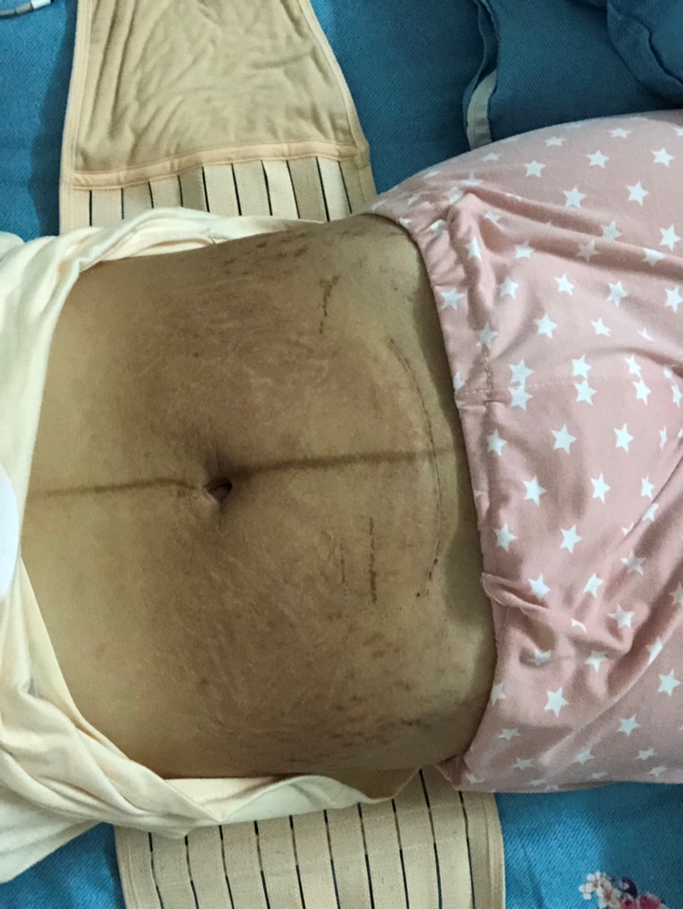 为什么生完之后肚子中间这块这么黑？以后会恢复正常吗？