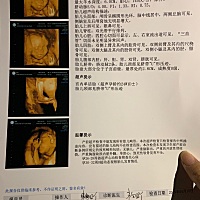 可以帮我看看是男宝还是女宝吗？好想要个女孩子！女孩子太可爱了