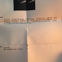 我感觉按月经最后一次来算 不对 上个星期做了b超 没有超出来 医生说过一个星期复查 我今天去可以看到东...