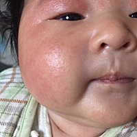 这脸上都是什么东东？昨天中午嗮10分钟有关系吗？