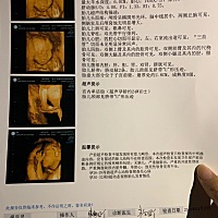 可以帮我看看是男宝还是女宝吗？