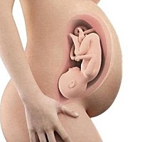 胎儿不入盆是怎么回事？这3点你要心中有数！   分娩的日子临近了，胎儿却迟迟不入盆，难免让孕妈妈们担...