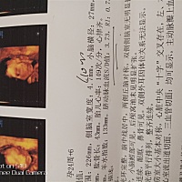 四维彩超，宝妈们看看，是乔治，还是佩奇！😂😝😜😜😜