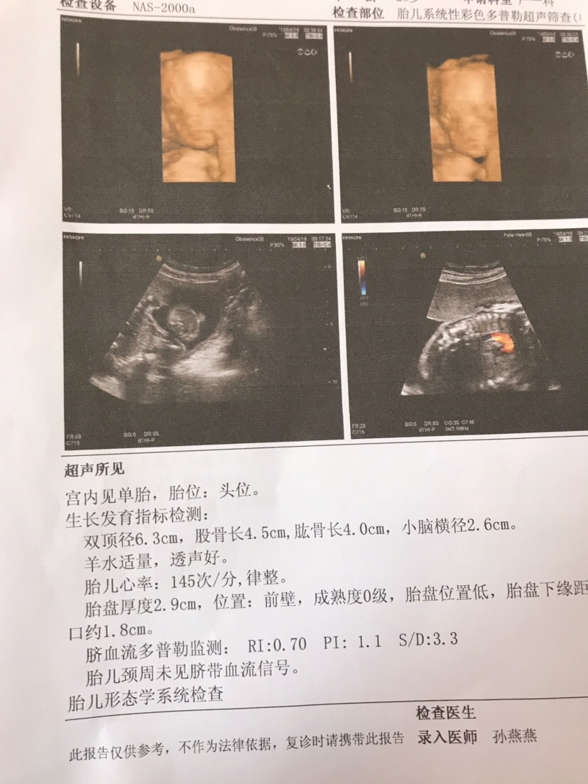 帮忙看男宝女宝～