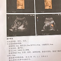 能出四维男宝女宝吗？ 帮忙看男宝女宝～