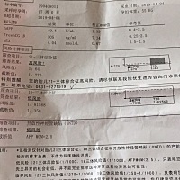 唐氏筛查，显示21-三体综合症高风险，有没有了解情况的😱