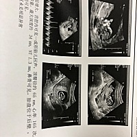 大家帮忙看看是男性女孩